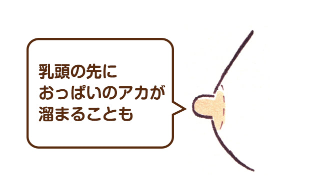 乳頭の先のアカは、オイルを使ってやさしくケア！