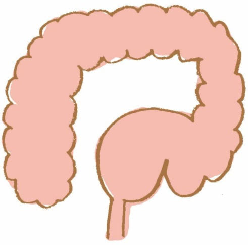 先天性巨大結腸　イラスト