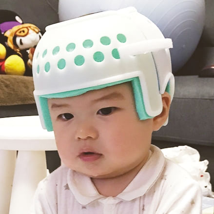 赤ちゃん　頭の形