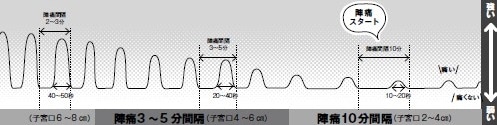 陣痛　陣痛間隔　痛み