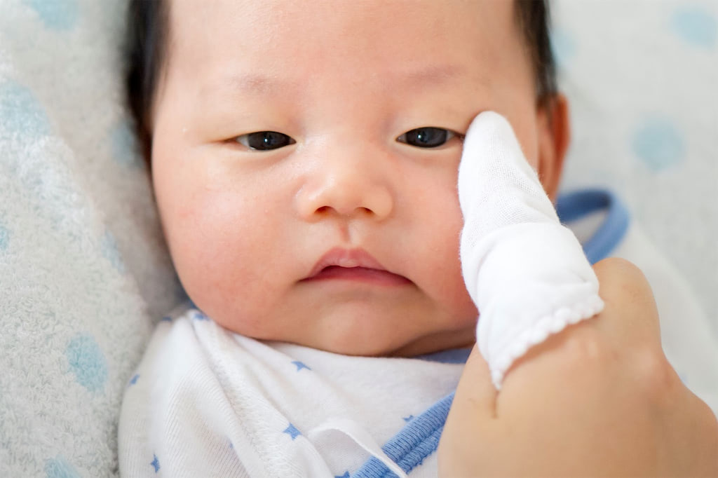 新生児　目やに