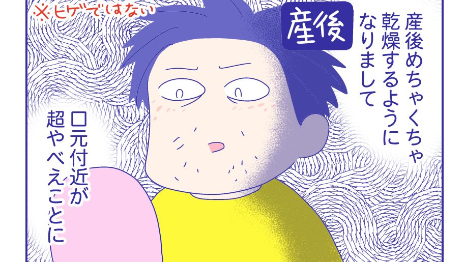 産後の肌荒れ・吹き出物。これって加齢？『新米ママぴろよの部屋』Vol.24