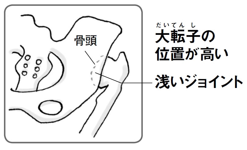赤ちゃん　股関節