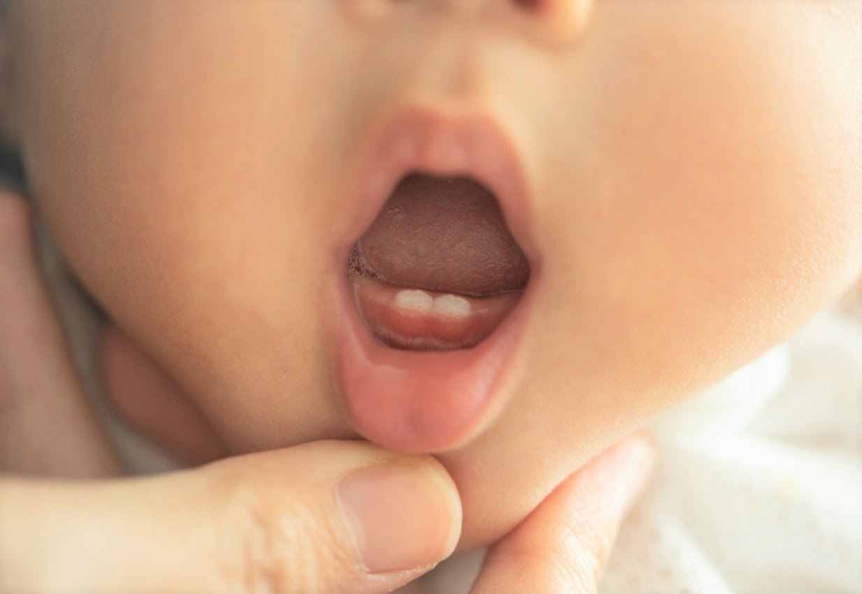 子どもの歯並びは親の責任？赤ちゃんでも歯列矯正はできますか？