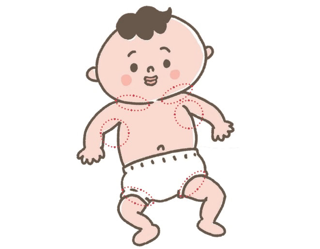 熱中症　冷やす