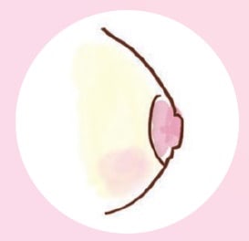 乳頭　扁平
