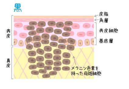 ほくろができるメカニズム