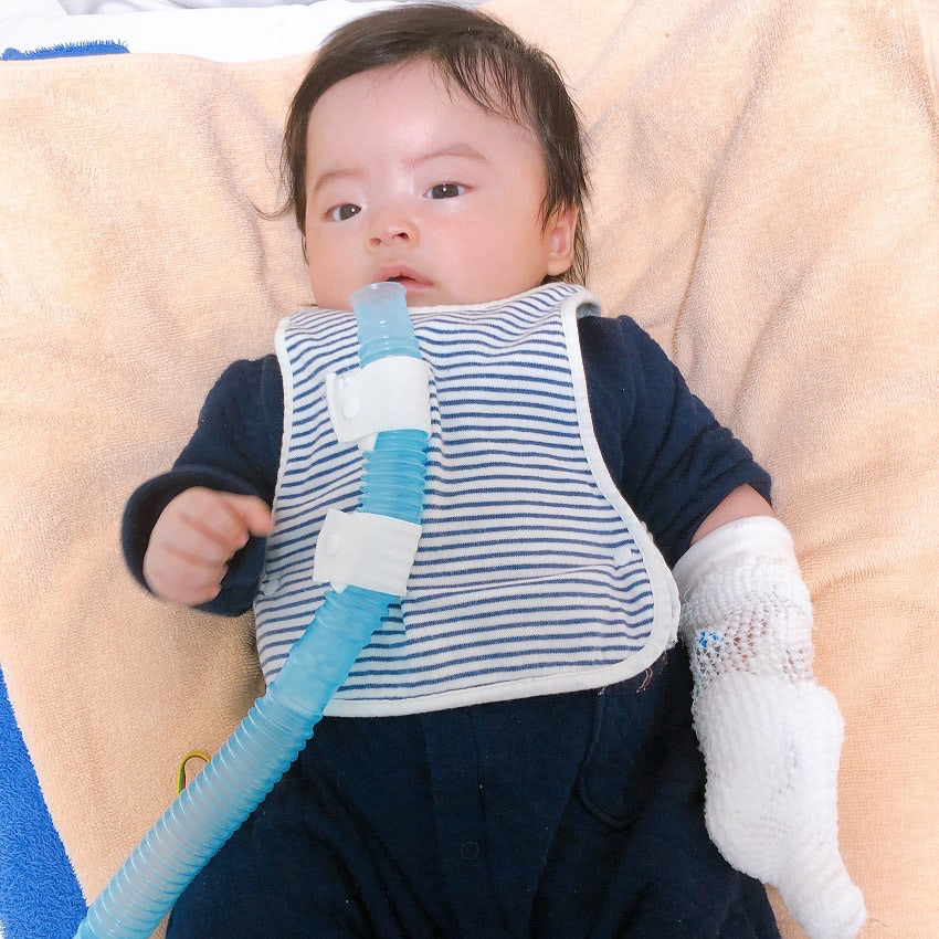 赤ちゃん　入院