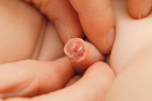 赤ちゃん　おちんちん　むき方