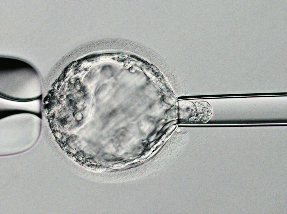 PGT-A(着床前胚染色体異数性検査)ってどんな診断?みんなが受けられる?