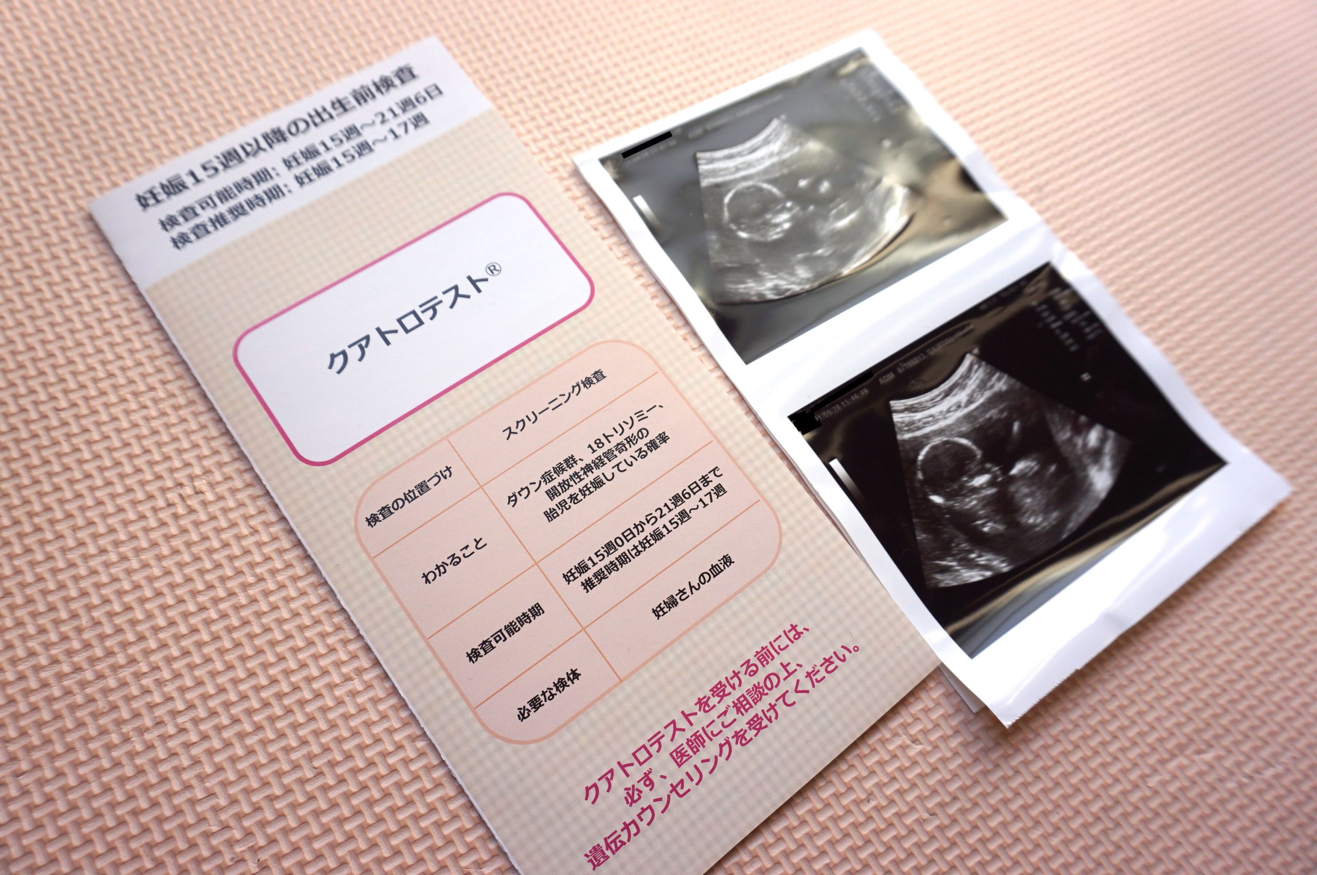 「ダウン症の確率が22分の１」と聞き、頭の中が真っ白に。 羊水検査の結果が出るまで自問自答した35歳妊婦の体験談【出生前検査】