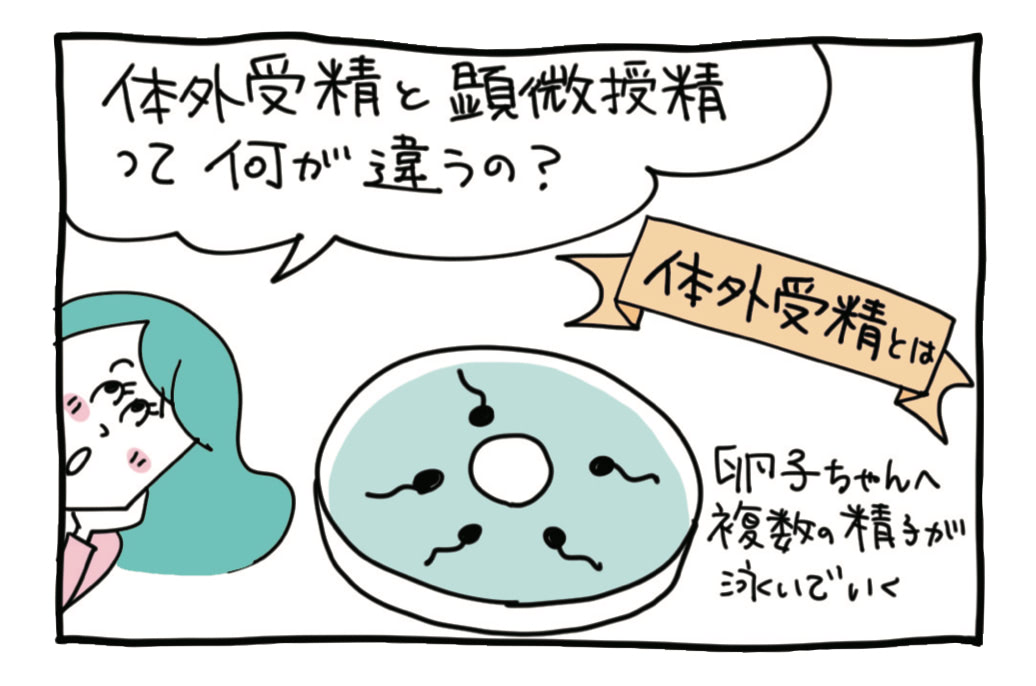 体外受精はふりかける、顕微授精は注入する。では、顕微授精が向いている人は？【不妊治療専門ドクター監修】