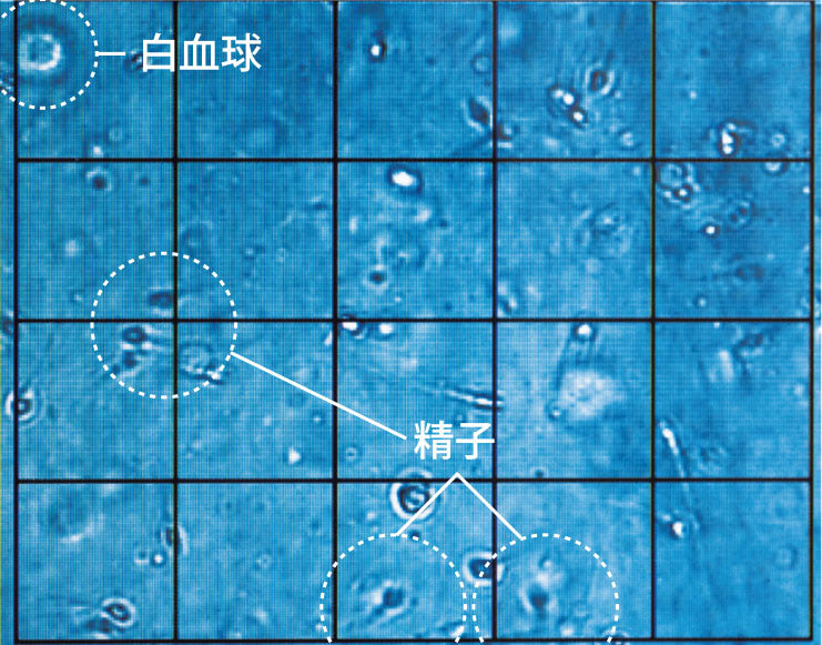 【精液検査の数値】をくらべてみた！ 年齢・職業・生活習慣別の妊娠アドバイス