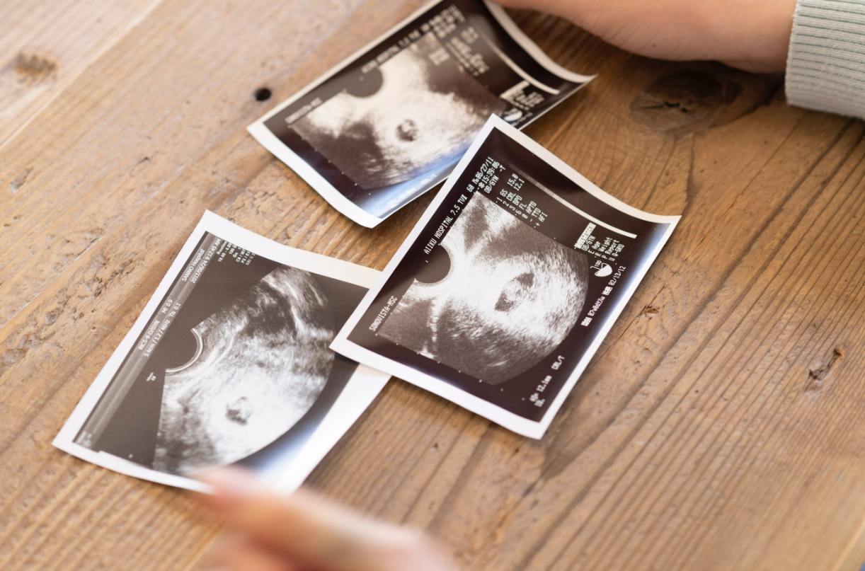「子どもはあきらめよう」からの夫と二人三脚で不妊治療を乗り越えママ＆パパに。体外受精・顕微授精からの妊娠【オメデタ体験談】
