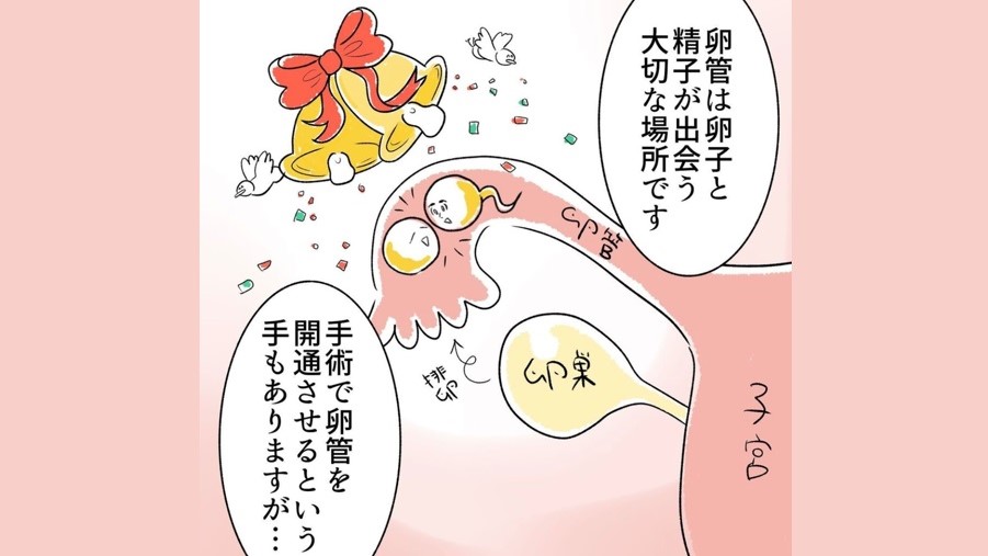 卵管閉塞にガッカリしていたら、先生がすすめてきたのはいきなり「顕微授精」だった件。【不妊治療リアル体験談記録#26】