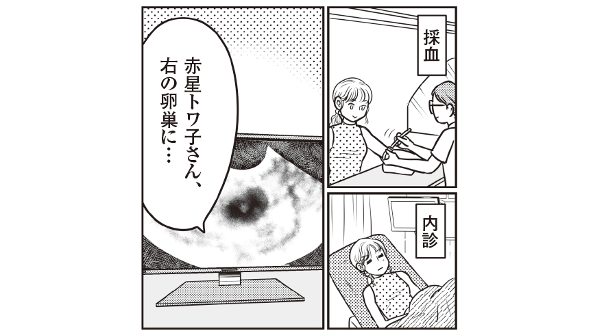 「トワ子さん、右の卵巣に…」採卵、内診、点鼻薬に座薬。採卵に向けてやることって【有名クリニックの治療をマンガ化】