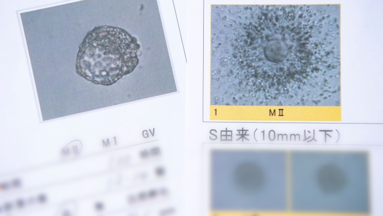 胚盤胞移植の着床率を上げるために重要なことや見直すべき生活習慣
