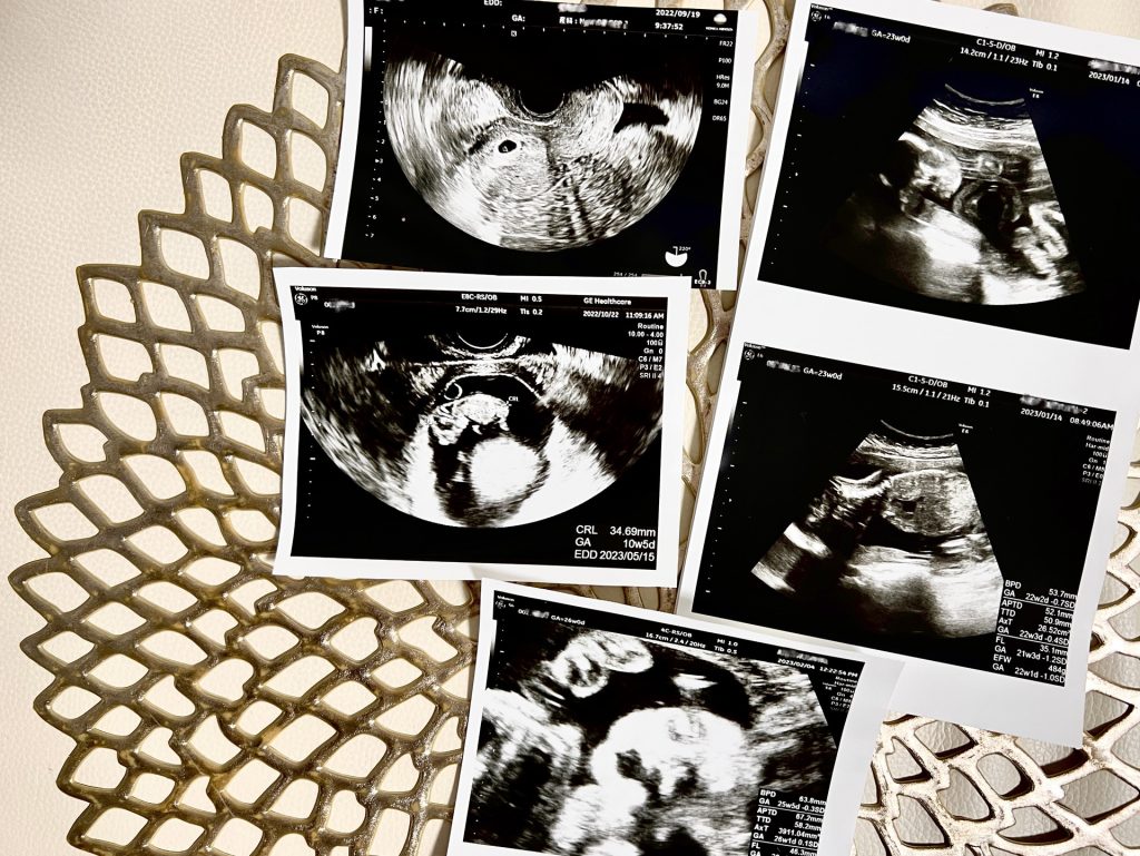 できれば3歳差で子育てしたいけれど。