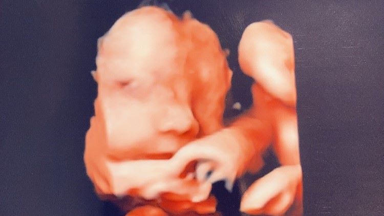あこがれの幼稚園の先生に！だけど、妊活との両立は難しかった。退職勧告も…【100人の妊活・不妊治療記＃006】