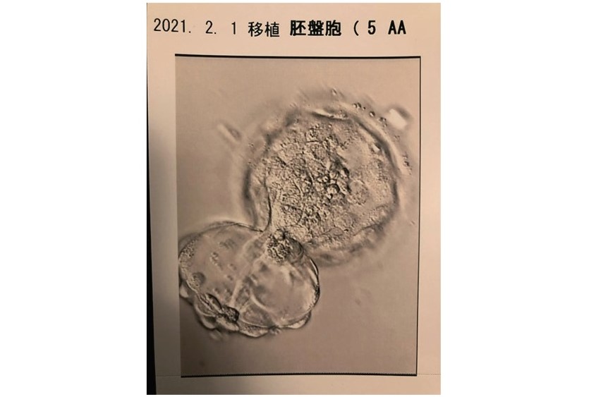 胚盤胞