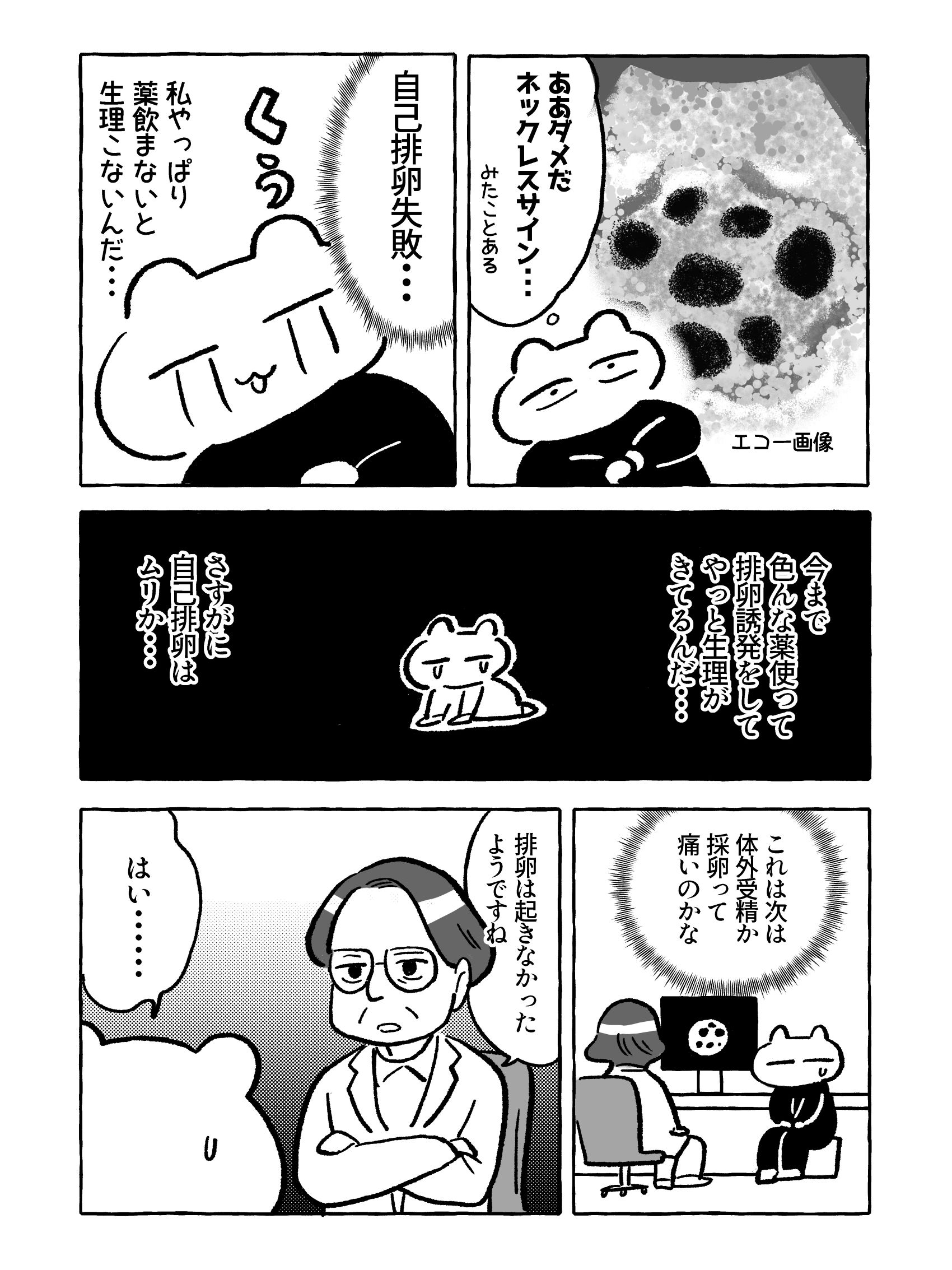 【たまごひめの妊活記】わたし、多嚢胞性卵巣でした(1)