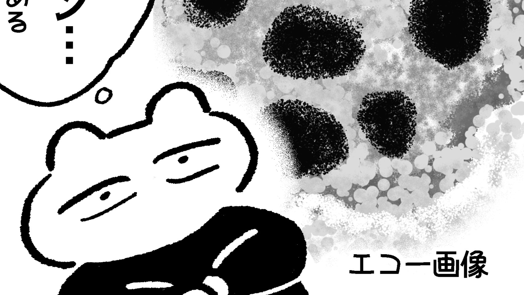 【たまごひめの妊活記】わたし、多嚢胞性卵巣でした