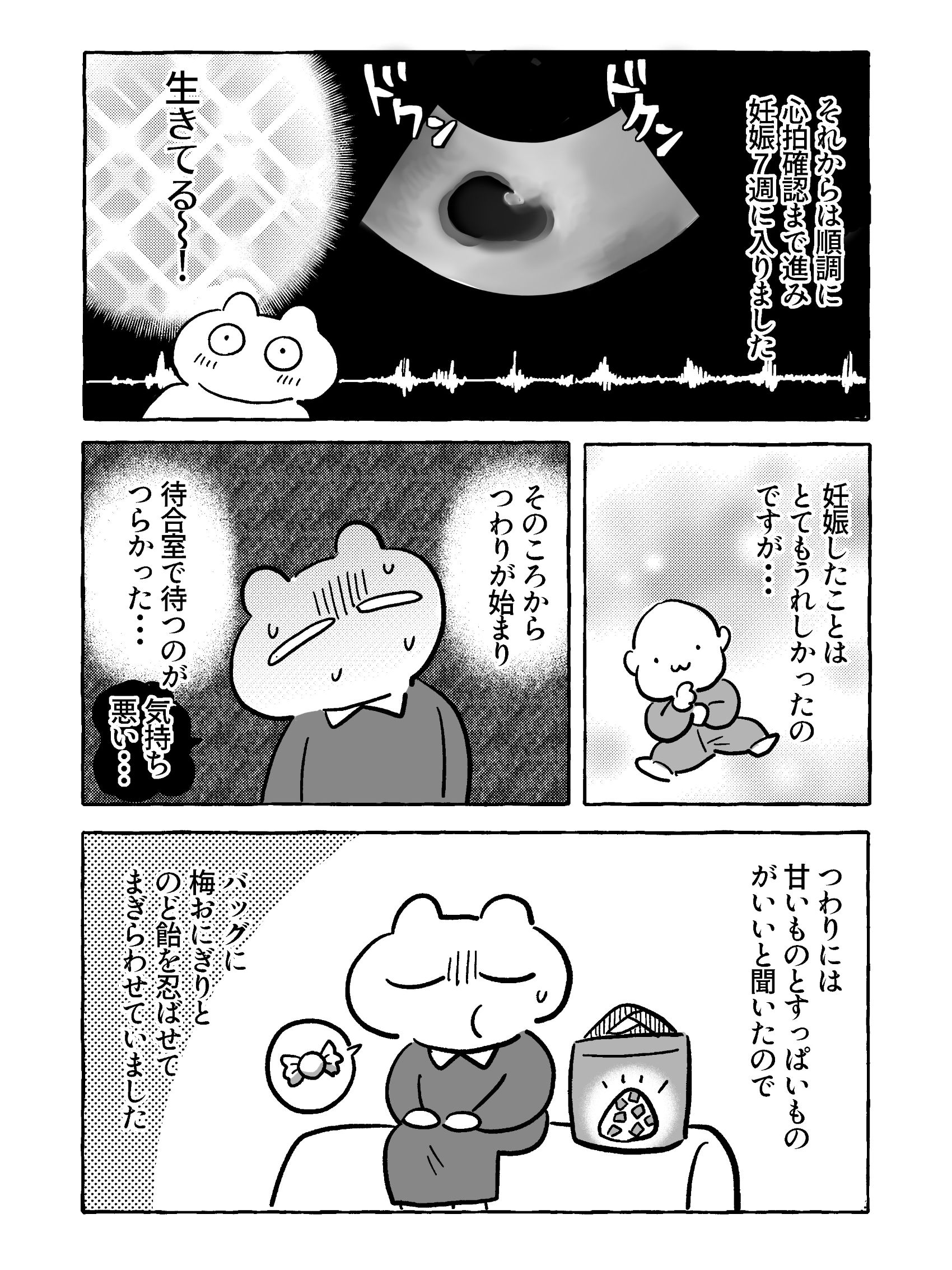 【たまごひめの妊活記】わたし、多嚢胞性卵巣でした