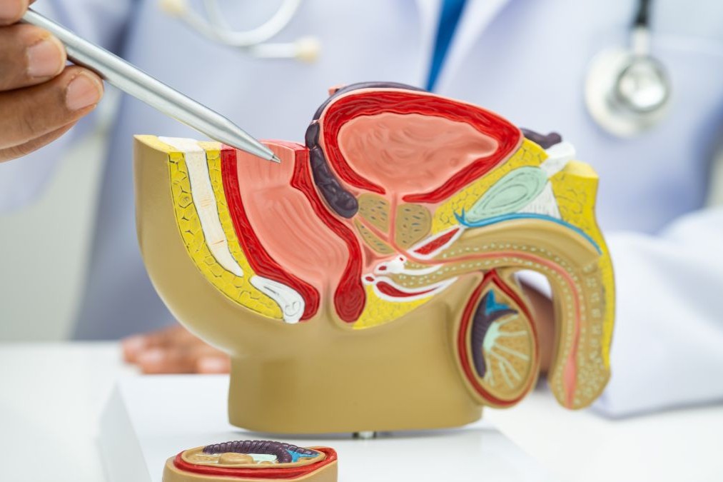 男性不妊