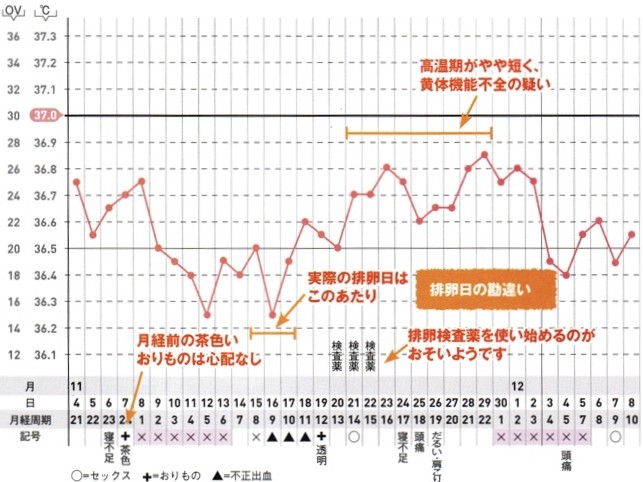 私のリズムどう？「2相にならない」「流産後から不安定に」妊活女子3名の基礎体温をドクターが診断！